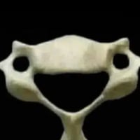 Vertebra C6