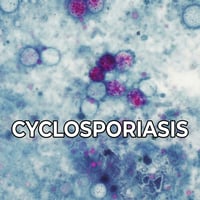 Cyclosporiasis
